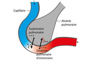 L'oedème pulmonaire d'immersion (OPI) - Plongée Plaisir, site officiel